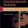 Genitourinary Imaging: A Core Review-EPUB