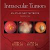 Intraocular Tumors: An Atlas and Textbook Third edition-EPUB