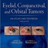 Eyelid, Conjunctival, and Orbital Tumors: An Atlas and Textbook Third edition-EPUB