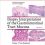 Biopsy Interpretation of the Gastrointestinal Tract Mucosa: Volume 1: Non-Neoplastic Third edition-EPUB
