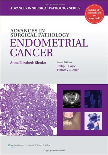 Advances in Surgical Pathology: Endometrial Carcinoma – Original PDF