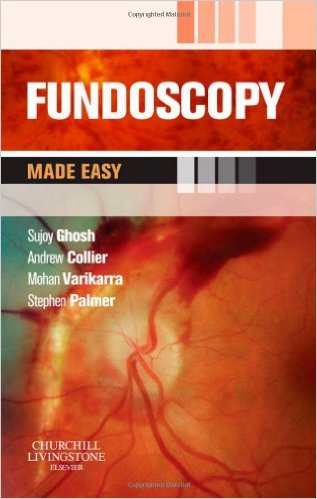 Fundoscopy Made Easy