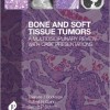 Bone and Soft Tissue Tumours: A Multidisciplinary Review With Case Presentations