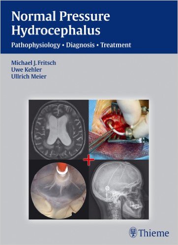 NPH – Normal Pressure Hydrocephalus: Pathophysiology – Diagnosis – Treatment – Original PDF