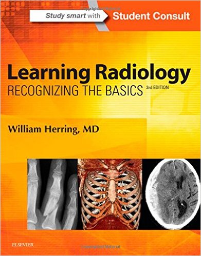 Learning Radiology: Recognizing the Basics, 3e – Original PDF