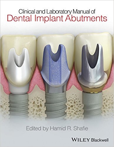 Clinical and Laboratory Manual of Dental Implant Abutments – Original PDF