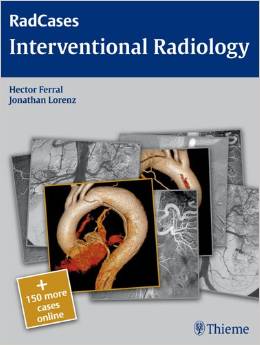 Interventional Radiology (RadCases) – Original PDF