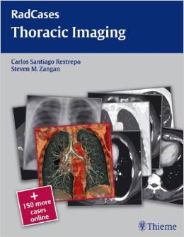 Thoracic Imaging (Radcases) – Original PDF