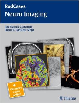 Neuro Imaging (Radcases) – Original PDF