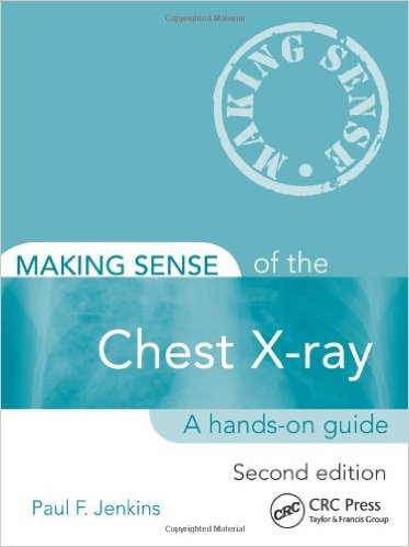 Making Sense of the Chest X-ray, Second Edition: A hands-on guide – Original PDF