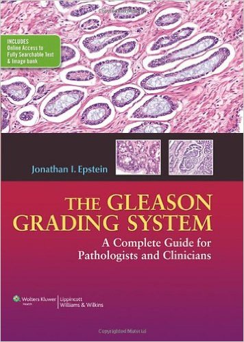 The Gleason Grading System: A Complete Guide for Pathologist and Clinicians – Original PDF