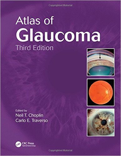 Atlas of Glaucoma, Third Edition