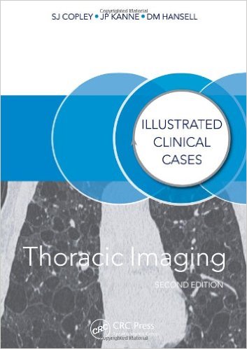 Thoracic Imaging Illustrated Clinical Cases, Second Edition – Original PDF