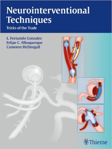 Neurointerventional Techniques Tricks of the Trade – Original PDF