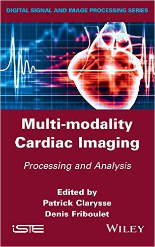 Multi-modality Cardiac Imaging: Processing and Analysis (Iste) – Original PDF