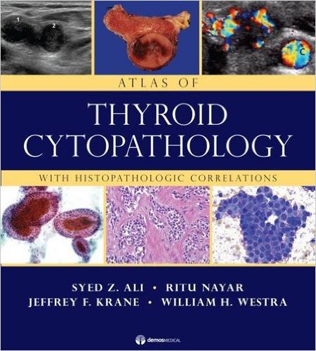 Atlas of Thyroid Cytopathology: With Histopathologic Correlations – Original PDF