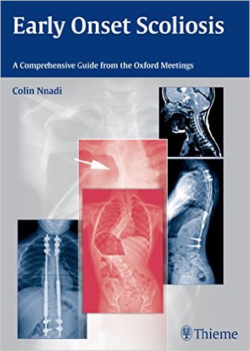 Early Onset Scoliosis : A Comprehensive Guide from the Oxford Meetings