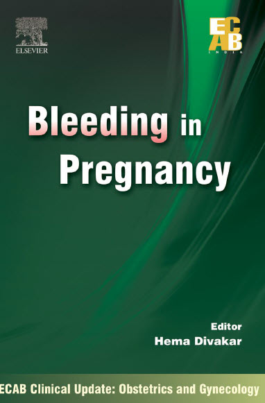 Bleeding in Pregnancy – ECAB