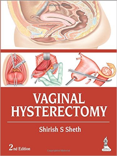 Vaginal Hysterectomy 2nd Edition – Original PDF
