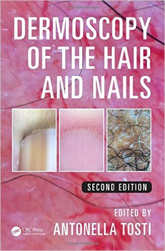 Dermoscopy of the Hair and Nails, Second Edition – Original PDF