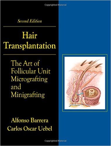 Hair Transplantation: The Art of Micrografting and Minigrafting, Second Edition