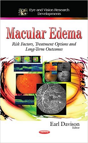 Macular Edema Risk Factors, Treatment Options and Long-Term Outcomes (Eye and Vision Research Developments)