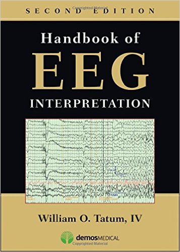 Handbook of EEG Interpretation , 2nd Edition (Publisher Version PDF)