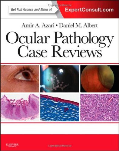 Ocular Pathology Case Reviews: Expert Consult – Online and Print, 1e – Original PDF
