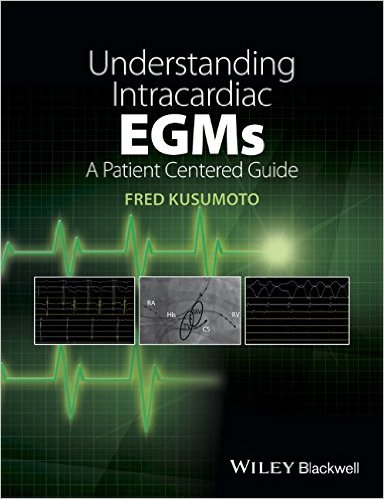 Understanding Intracardiac EGMs: A Patient Centered Guide – Original PDF