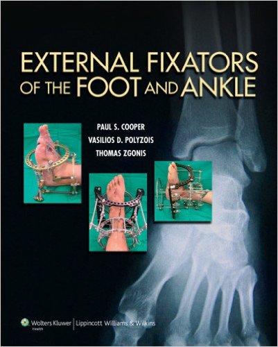 External Fixators of the Foot and Ankle – Original PDF