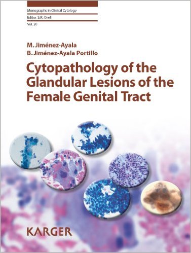 Cytopathology of the Glandular Lesions of the Female Genital Tract Vol20 – Original PDF