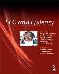 EEG and Epilepsy – Original PDF