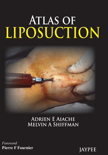 Atlas of Liposuction – Original PDF