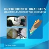 Orthodontic Brackets: Selection,Placement and Debonding 1st Edition – Original PDF