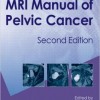 MRI Manual of Pelvic Cancer, Second Edition – Original PDF