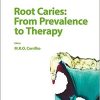 Root Caries: From Prevalence to Therapy (Monographs in Oral Science, Vol. 26)-Original PDF