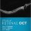 Atlas of Retinal OCT: Optical Coherence Tomography, 1e-Original PDF
