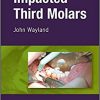 Impacted Third Molars-Original PDF