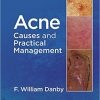 Acne: Causes and Practical Management-Original PDF