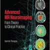 Advanced MR Neuroimaging: From Theory to Clinical Practice (Series in Medical Physics and Biomedical Engineering)-Original PDF