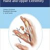 Reconstructive Surgery of the Hand and Upper Extremity-EPUB