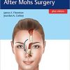 Facial Reconstruction After Mohs Surgery-EPUB