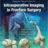 Illustrated Tips and Tricks for Intraoperative Imaging in Fracture Surgery-EPUB