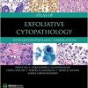 Atlas of Exfoliative Cytopathology: With Histopathologic Correlations-Original PDF