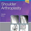 Shoulder Arthroplasty, 2e-Original PDF