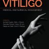 Vitiligo: Medical and Surgical Managmement-Original PDF