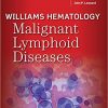 Williams Hematology Malignant Lymphoid Diseases-Original PDF