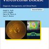 Vitreoretinal Disease: Diagnosis, Management, and Clinical Pearls 2nd Edition-EPUB