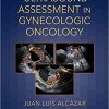 Ultrasound Assessment in Gynecologic Oncology-Original PDF