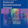 Handbook of Cerebrovascular Disease and Neurointerventional Technique (Contemporary Medical Imaging) 3rd ed. 2018 edition-Original PDF